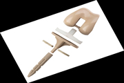 ORGKnee-implant ORGKnee-implant