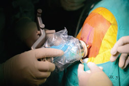 brain-surgery brain-surgery